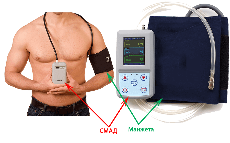 Прибор смад. СМАД аппарат для измерения давления. Аппарат СМАД для измерения давления суточный. Холтеровское мониторирование ад. СМАД е070.